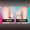 Exploring Unexpected Health Benefits of Birth Control